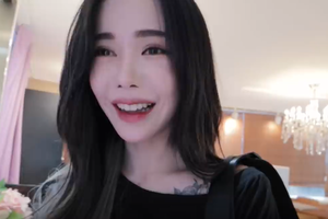 진아님 리터치 루미에르 방문 후 시술후기영상